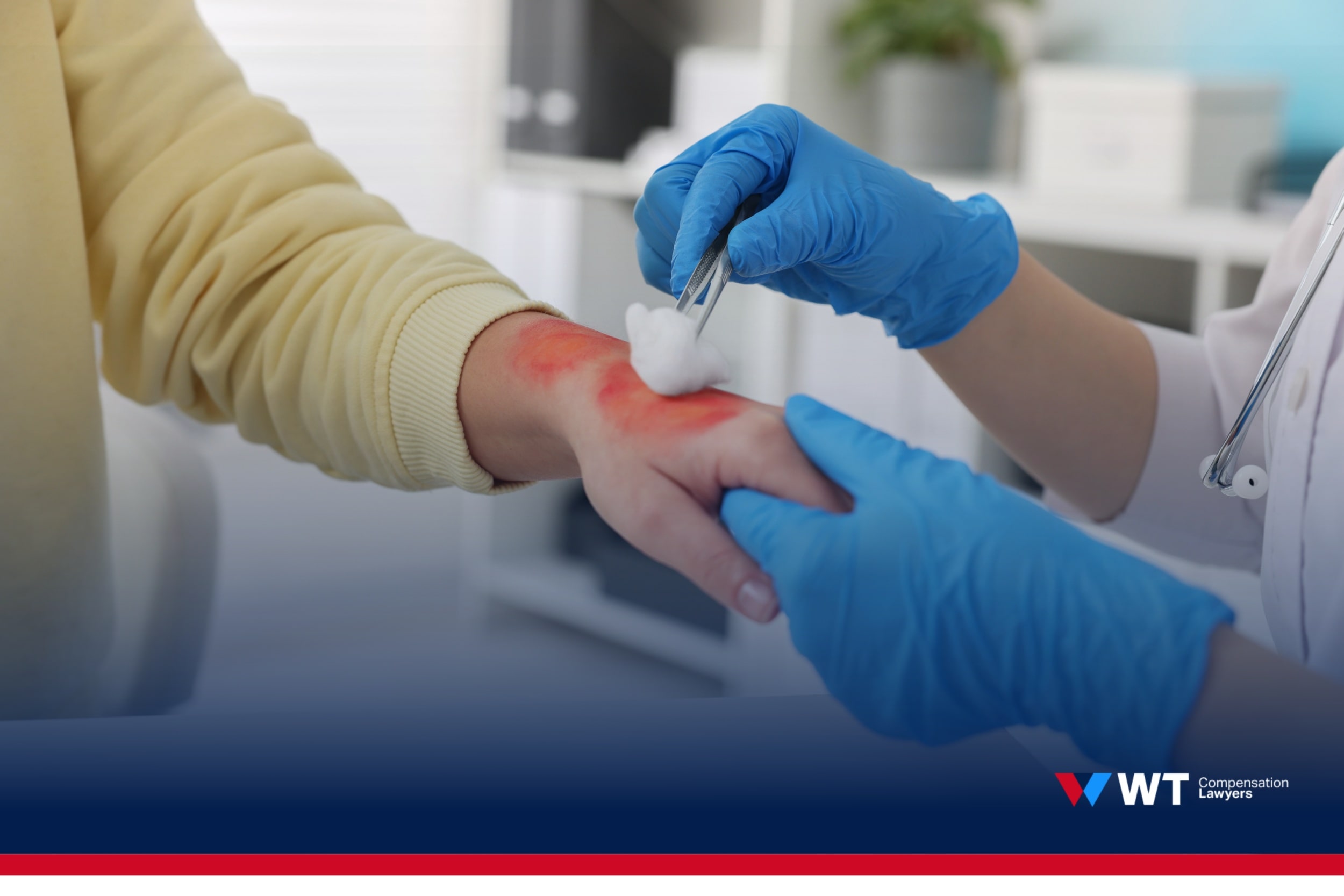 burn injury compensation, qld