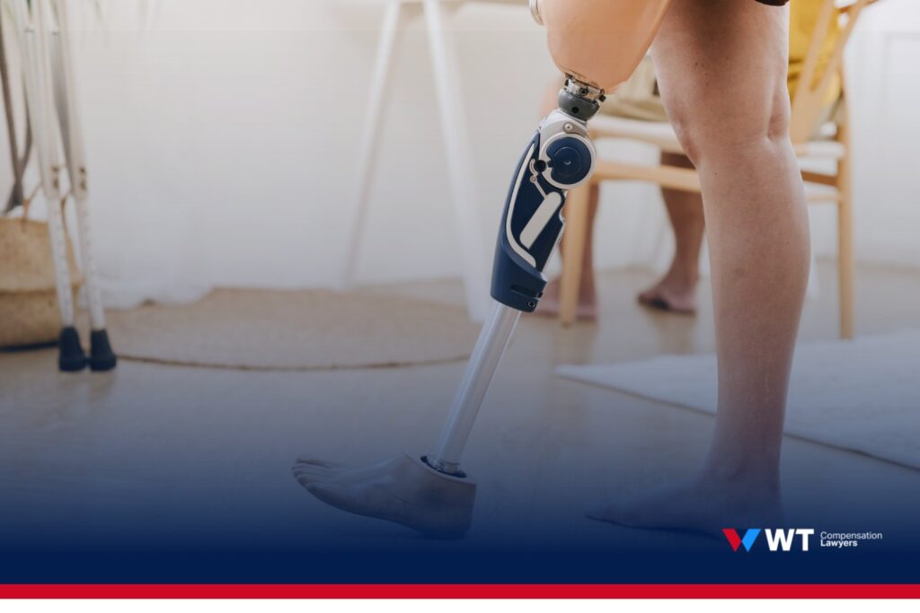 can you claim compensation in qld if you’ve lost a limb
