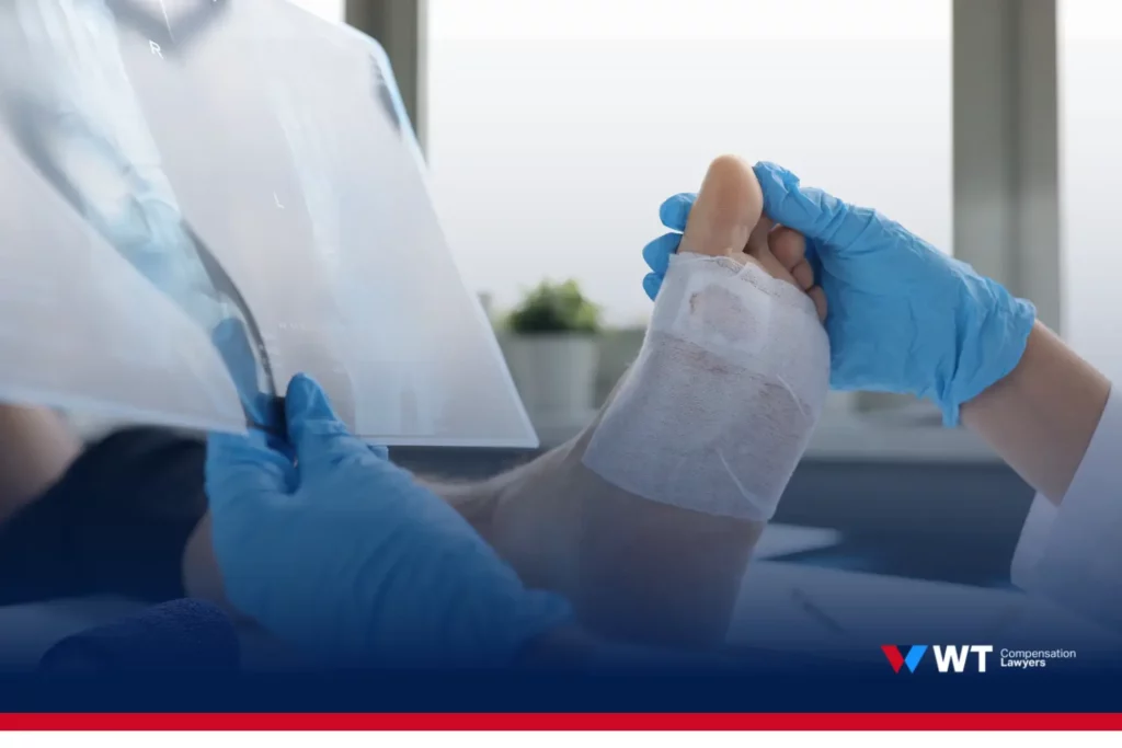 what are you compensated for after a foot injury